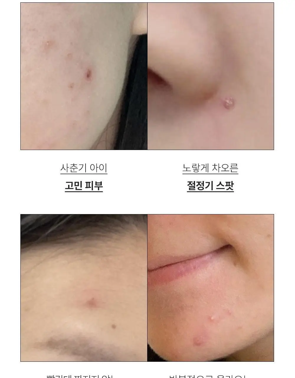 [트러블케어/스팟진정] 퍼셀 익스트림 이펙트 터피네올 원액 10ml 상세페이지 3